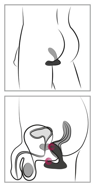 Masażer prostaty z wibracjami, na pilota, bardzo elastyczny, 9,5 cm, inteligentny tryb wibracji